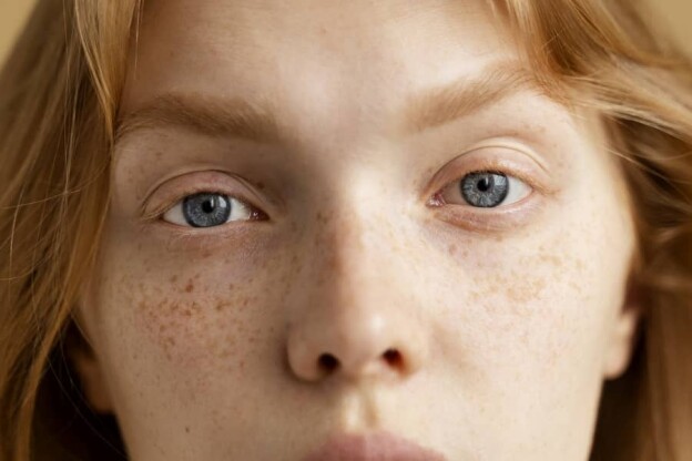close-up-beautiful-woman-with-freckles